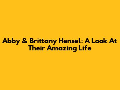 Abby & Brittany Hensel: A Look At Their Amazing Life