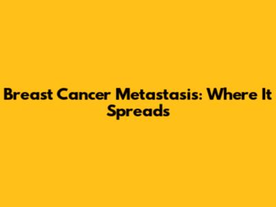 Breast Cancer Metastasis: Where It Spreads
